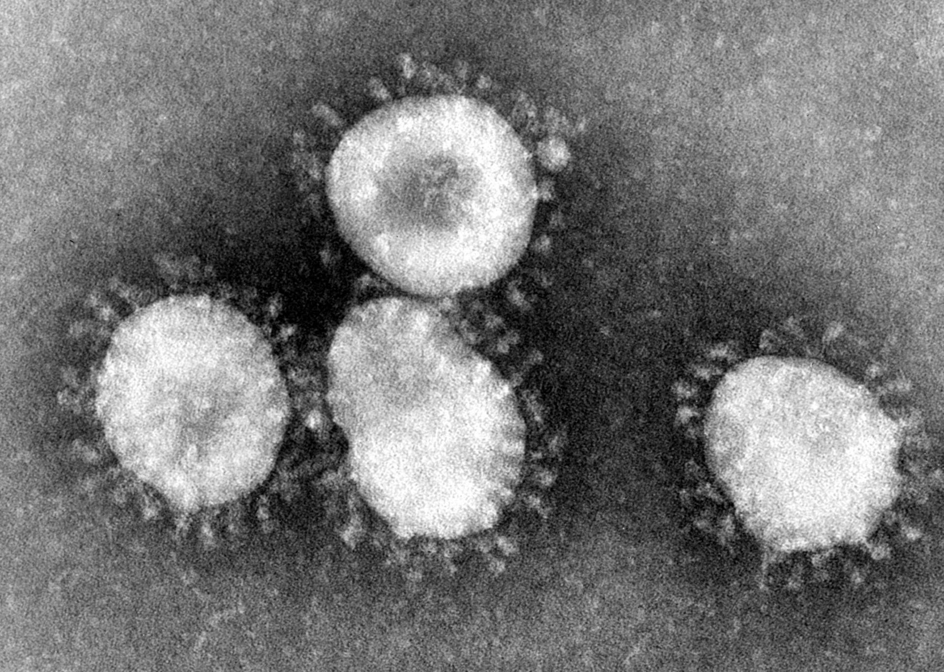 Fotografie Corona Virus (SARS-CoV-2)